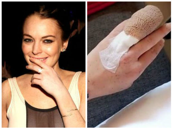 Lindsay Lohan Almost Lost A Finger This Weekend And It's Painful To Look At..