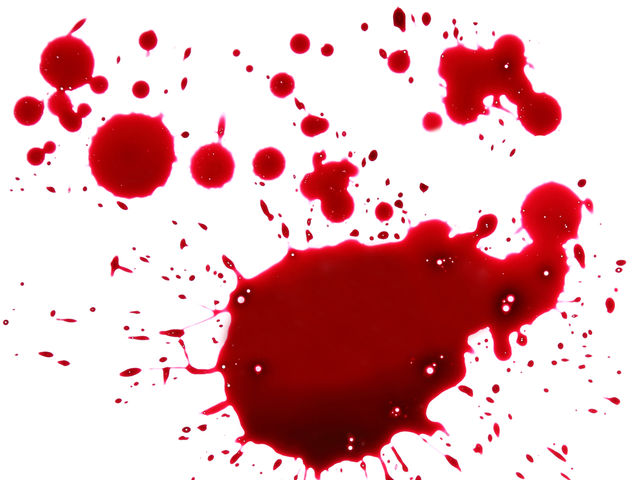 How Well Do You Know Your Medical Terminology? Playbuzz