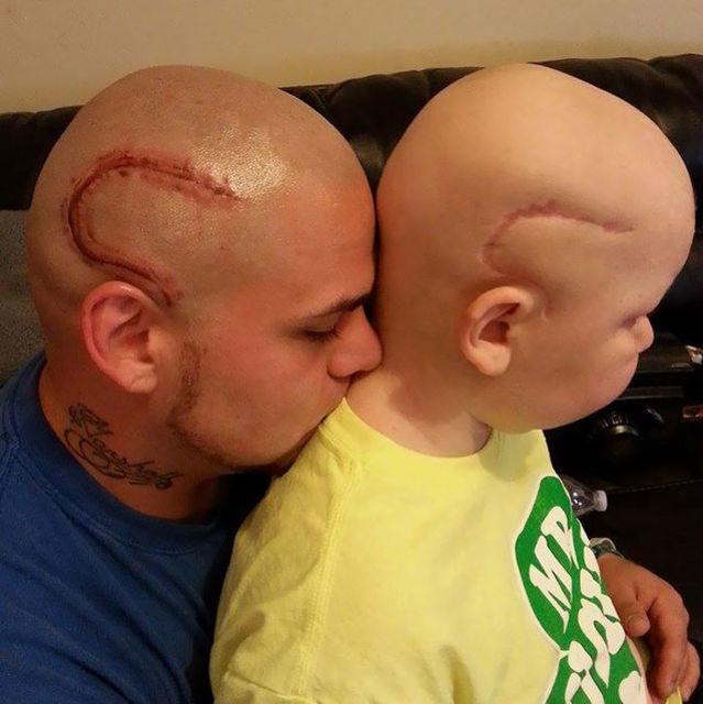 Գաբրիել Մարշալի մոտ 2015 թվականին ուղեղի չարորակ ուռուցք են ախտորոշել։ Տղային վիրահատելուց հետո նրա գլխին մեծ սպի է մնացել։ Նրա հայրը որոշել է նույնը դաջել իր գլխին, որպեսզի որդին չվհատվի։