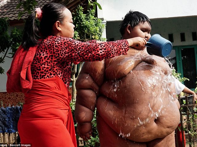 Из-за своего веса ребёнок даже не может принять душ &mdash; мать вынуждена поливать его из лейки.